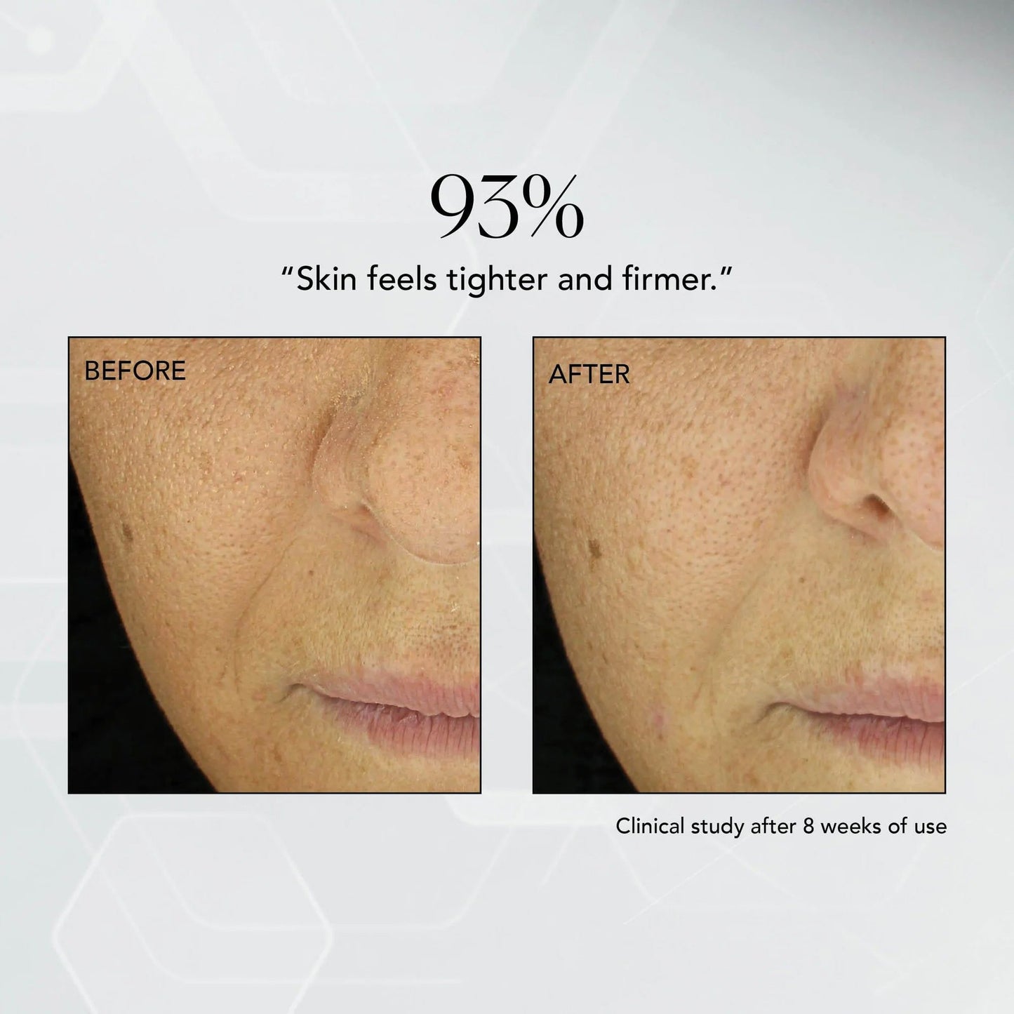 CREAM, FACIAL MD ADVANCED HYDRATING 1.7OZ
