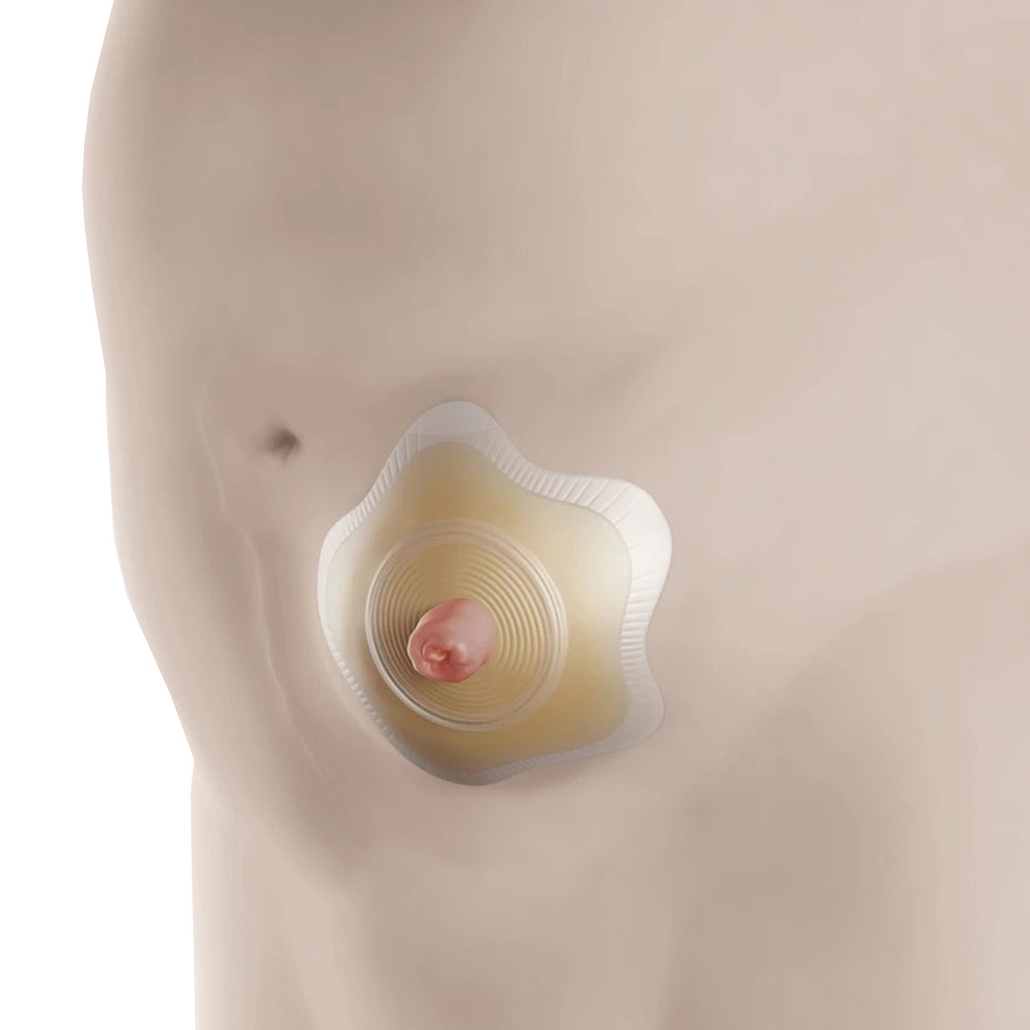 BARRIER, OSTOMY SENSURA MIO CLICK 2PC RED 1 3/8"