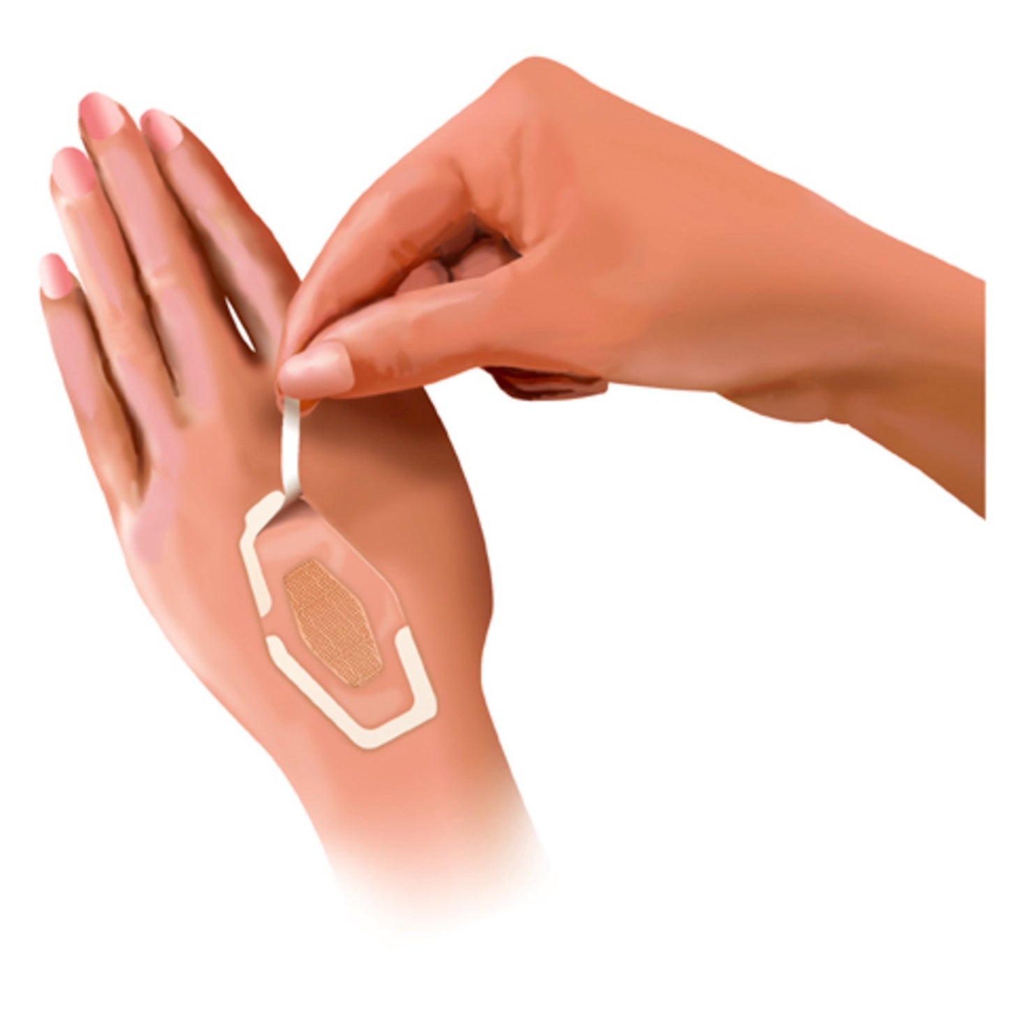 BANDAGE, NEXCARE WATERPROOF ASSORTED CLR