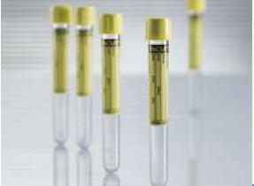 TUBE, VAC URINE W/O STABILIZER