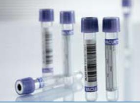 TUBE, BLD COL K2EDTA LAV/BLK 4ML PET VACUETTE