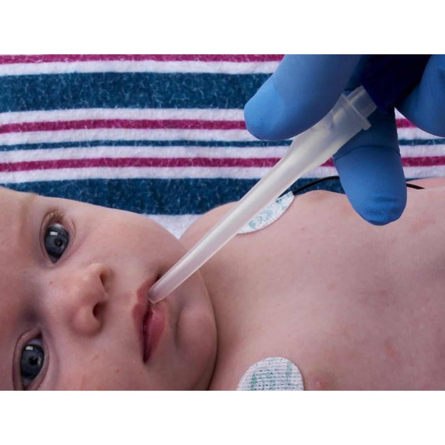 CATHETER, SCTN ORAL & NASAL DEVICE