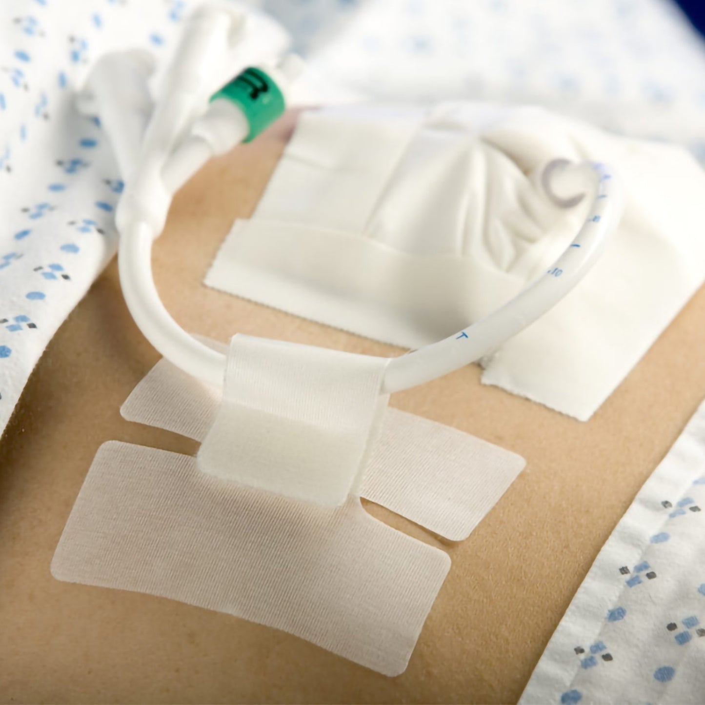 HOLDER, TUBE CATH-SECURE
