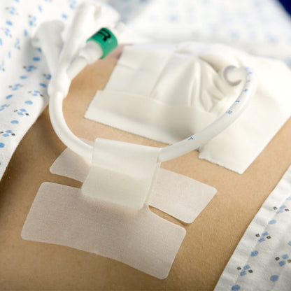 HOLDER, TUBE CATH-SECURE