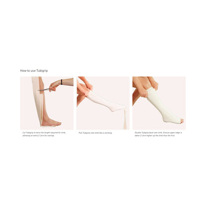 BANDAGE, TUBIGRIP SZK NATMOLYCK