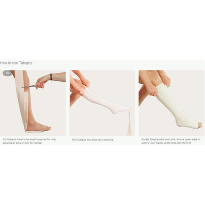 BANDAGE,TUBIGRIP LG ANKL/MED KNEE/SM THIGH SZE MOLYCK