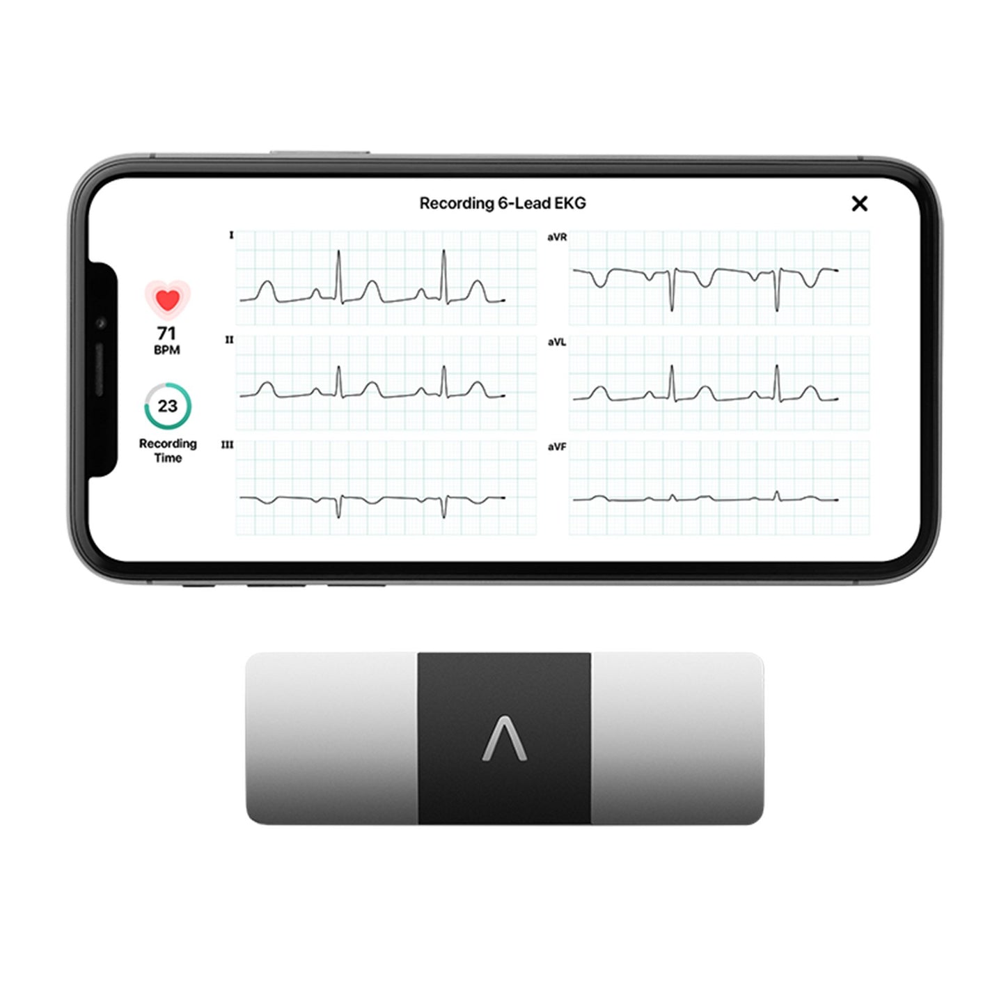 MONITOR, EKG KARDIA 6LEAD PORTPERSONAL