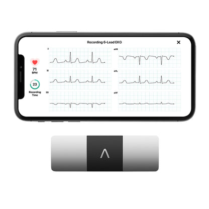 MONITOR, EKG KARDIA 6LEAD PORTPERSONAL