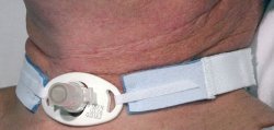 HOLDER, TRACH TUBE NEO