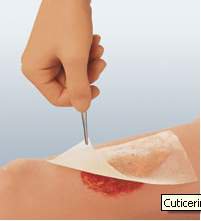 DRESSING, CUTICERIN GAUZE 3"X8"