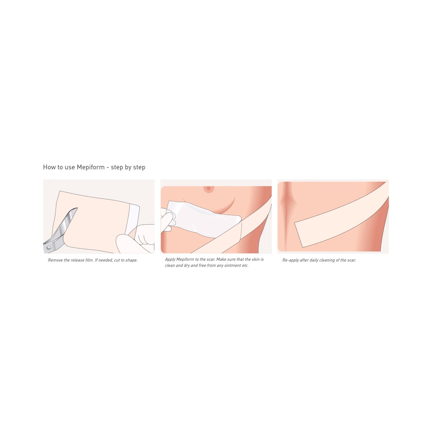 DRESSING, MEPIFORM 2X3"