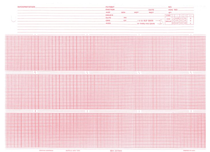 PAPER, ECG F/007944 8.5"X150'