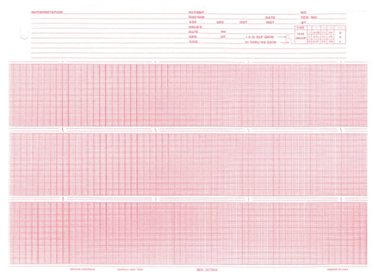 PAPER, ECG F/007944 8.5"X150'