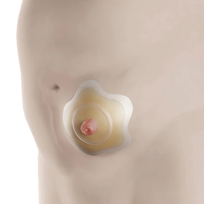 BARRIER, OSTOMY SENSURA MIO CLICK 2PC RED 1 3/8"