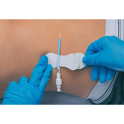 SECUREMENT, CATHETER/PICC GRIP-LOK MED