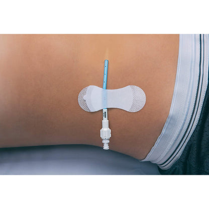 SECUREMENT, CATHETER/PICC GRIP-LOK MED