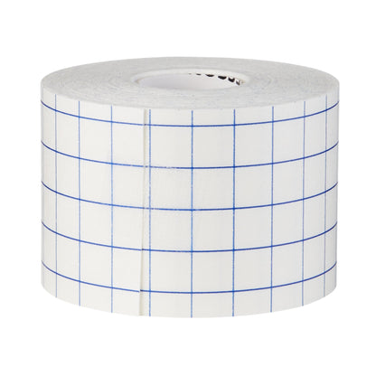 TAPE, RETENTION 2"X10YDS