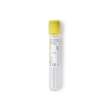 TUBE, URINALYSIS 8ML 16X100MLW/YLW TOP