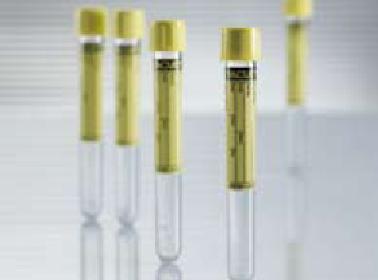 TUBE, VAC URINE 16X100 9.5ML NO BORIC