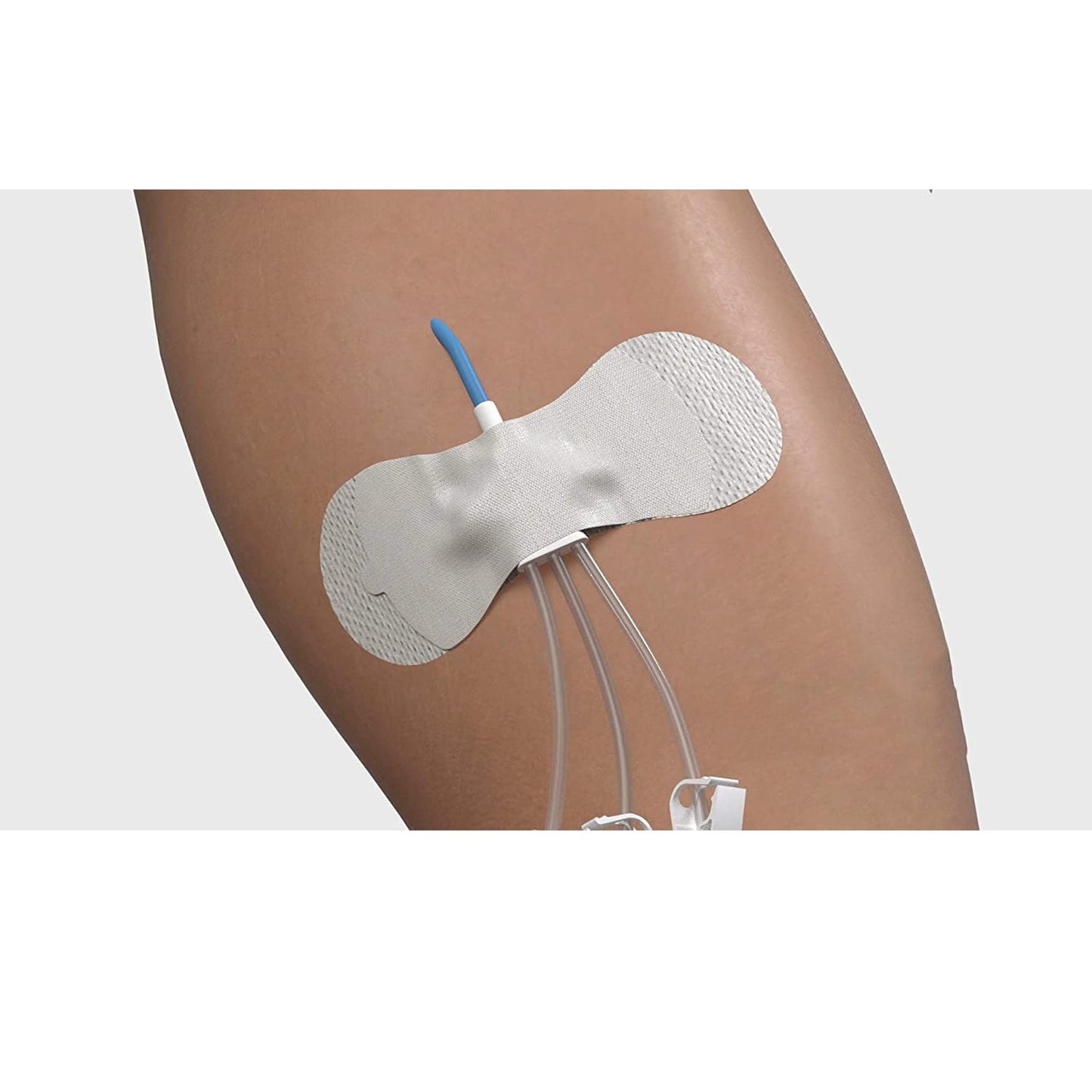SECUREMENT, CATHETER/PICC GRIP-LOK MED