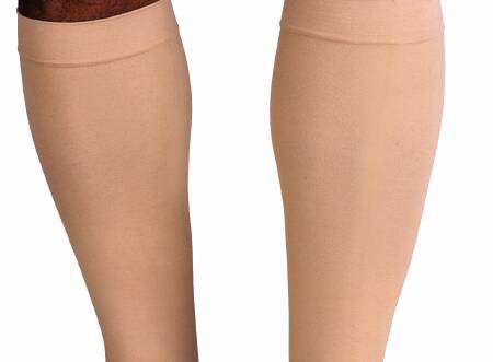 STOCKING, VASC KNEE BGE 20-30MMHG MED SNCAST