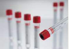 TUBE, BLD COL CLOT RED/BLK 9MLPET VACUETTE