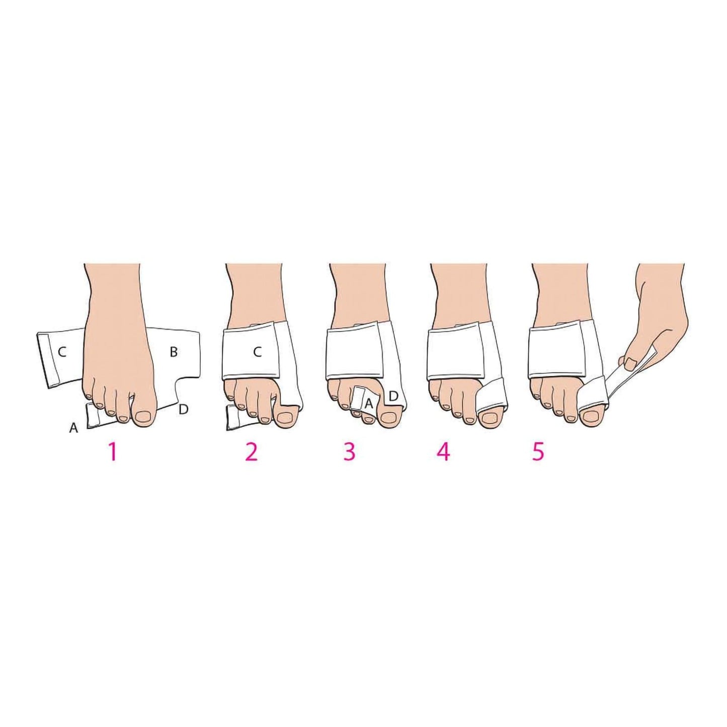 BUNION SPLINT MED/LFT SOFTPOST OP