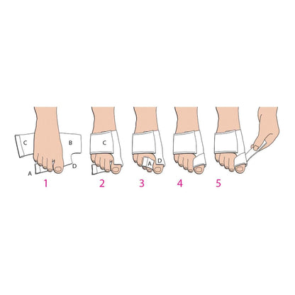 BUNION SPLINT MED/LFT SOFTPOST OP