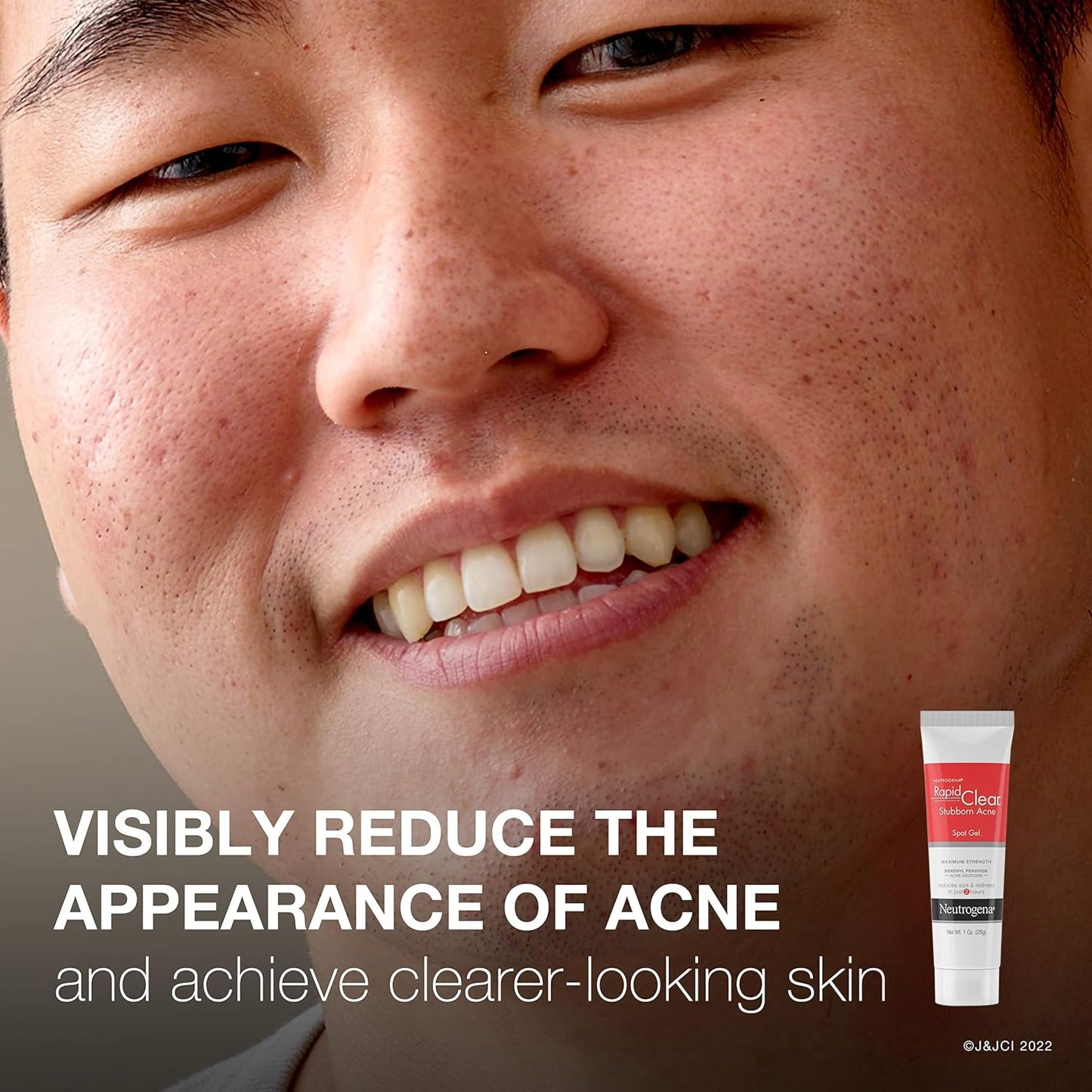 NEUTROGENA, GEL ACNE SPOT TRTMT RAPID CLR 1OZ