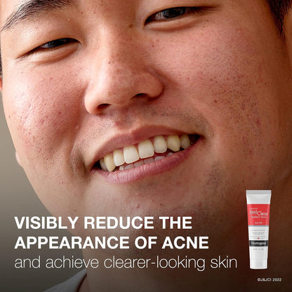 NEUTROGENA, GEL ACNE SPOT TRTMT RAPID CLR 1OZ