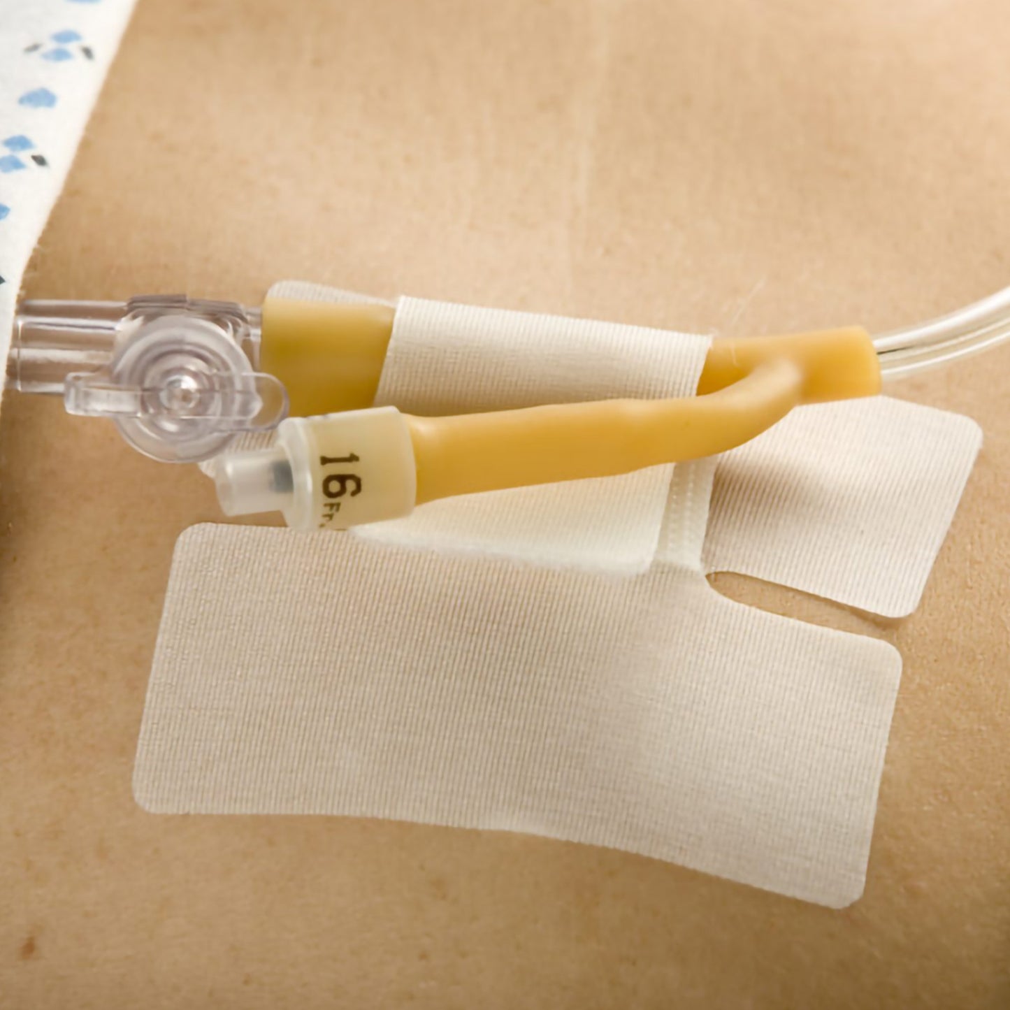 HOLDER, TUBE CATH-SECURE