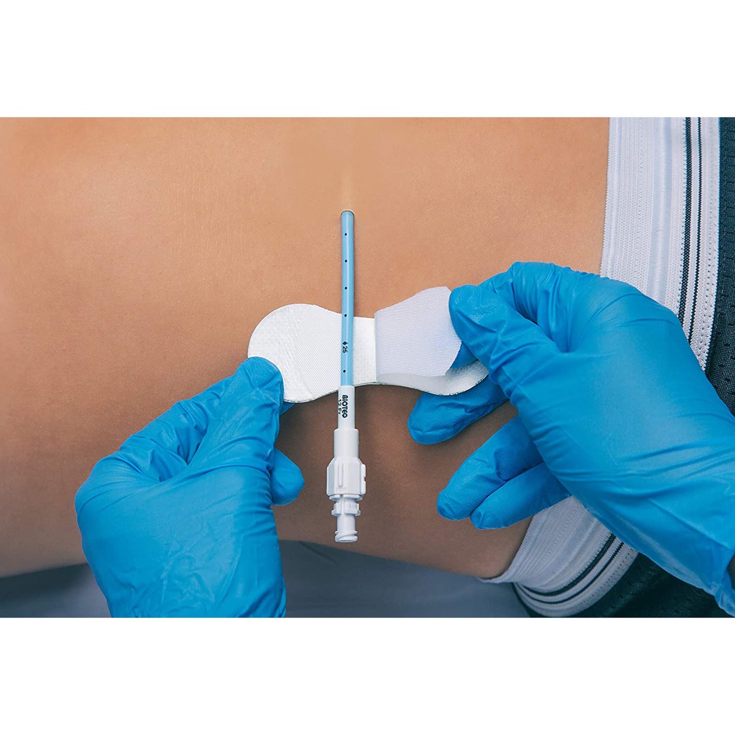 SECUREMENT, CATHETER/PICC GRIP-LOK MED